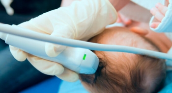 Estado oferece doppler transcraniano a crianças e adolescentes